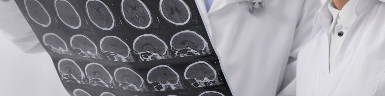 Ärzte untersuchen das EEG eines Patienten